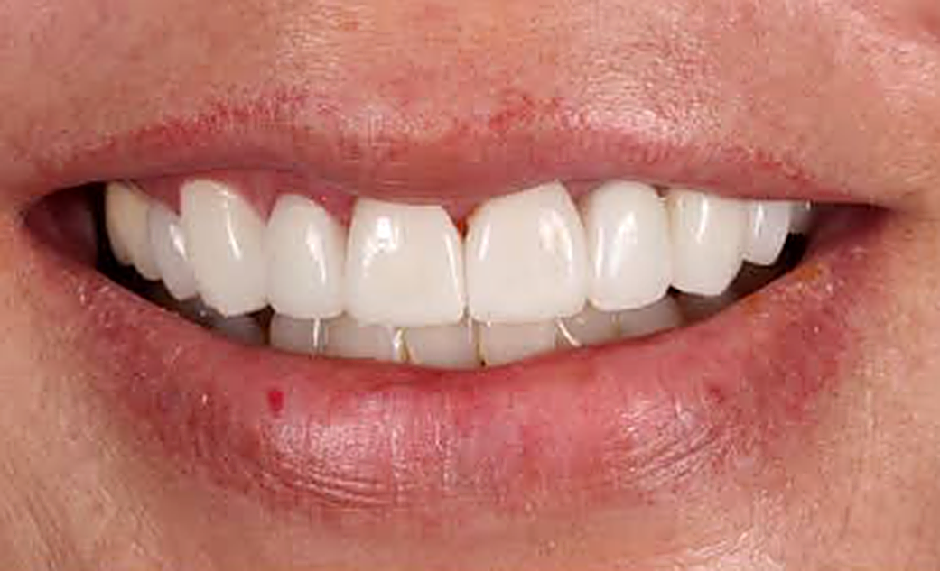 Refined Alignment & Vitality - After Treatment
